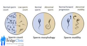 count modal Sperm