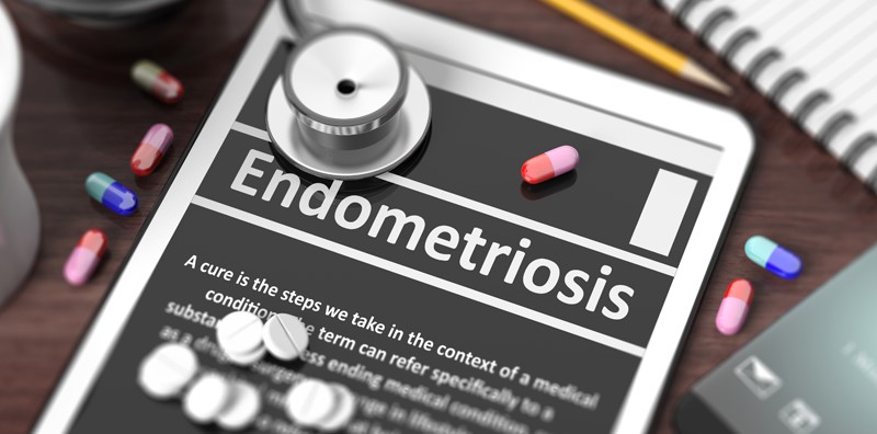 What is endometriosis and how can IVF help? 