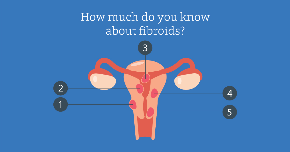 Do You Need to Worry About Fibroids?