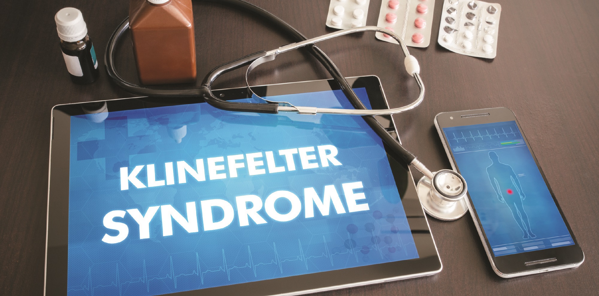 How Does Klinefelter Syndrome Affect Fertility 